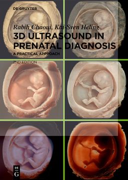 portada 3D Ultrasound in Prenatal Diagnosis: A Practical Approach (en Inglés)