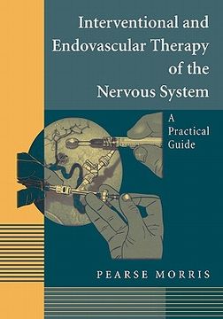 portada interventional and endovascular therapy of the nervous system: a practical guide (in English)
