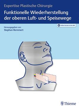 portada Funktionelle Wiederherstellung der Oberen Luft- und Speisewege: Expertise Plastische Chirurgie: Expertise Plastische Chirurgie (in German)