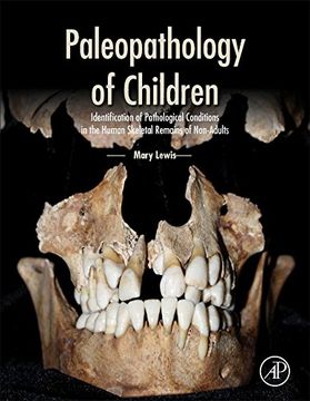 portada Paleopathology of Children: Identification of Pathological Conditions in the Human Skeletal Remains of Non-Adults
