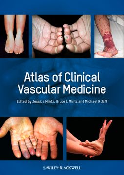portada atlas of clinical vascular medicine (in English)