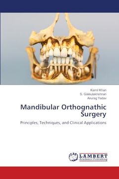 Mandibular Orthognathic Surgery (en Inglés)