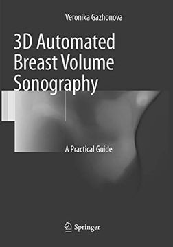 portada 3D Automated Breast Volume Sonography: A Practical Guide (en Inglés)