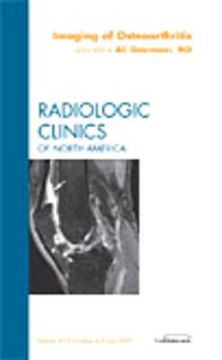 portada Imaging of Osteoarthritis, an Issue of Radiologic Clinics of North America: Volume 47-4 (en Inglés)