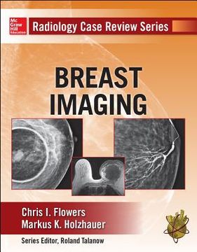 portada Radiology Case Review Series: Breast Imaging (en Inglés)