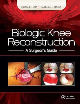 portada Biologic Knee Reconstruction: A Surgeon's Guide