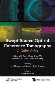 portada Swept-Source Optical Coherence Tomography: A Color Atlas (en Inglés)