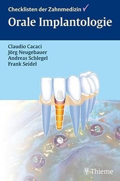 portada Checkliste Orale Implantologie (in German)