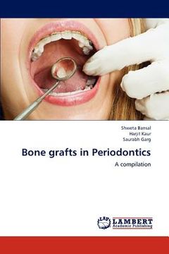 portada bone grafts in periodontics (en Inglés)