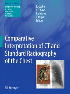 portada Comparative Interpretation of ct and Standard Radiography of the Chest (en Inglés)