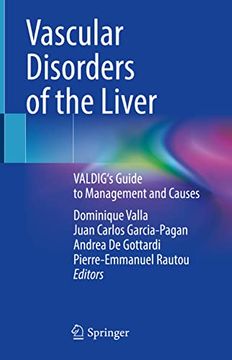 portada Vascular Disorders of the Liver: Valdig's Guide to Management and Causes (in English)