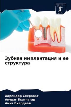 portada Зубная имплантация и ее &#1089 (en Ruso)