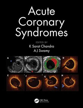 portada Acute Coronary Syndromes (in English)