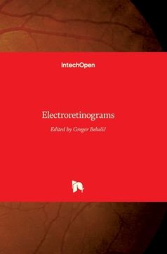 portada Electroretinograms (en Inglés)