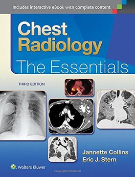 portada Chest Radiology: The Essentials (en Inglés)