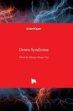 portada Down Syndrome (en Inglés)