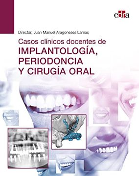 portada Casos Clínicos Docentes de Implantología, Periodoncia y Cirugía Oral (in Spanish)