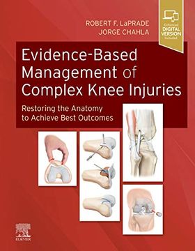portada Evidence-Based Management of Complex Knee Injuries: Restoring the Anatomy to Achieve Best Outcomes, 1e (in English)
