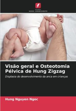 portada Vis�O Geral e Osteotomia P�Lvica de Hung Zigzag: Displasia do Desenvolvimento da Anca em Crian�As