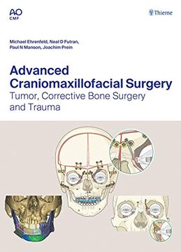 portada Advanced Craniomaxillofacial Surgery: Tumor, Corrective Bone Surgery, and Trauma (en Inglés)