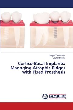 portada Cortico-Basal Implants: Managing Atrophic Ridges With Fixed Prosthesis 