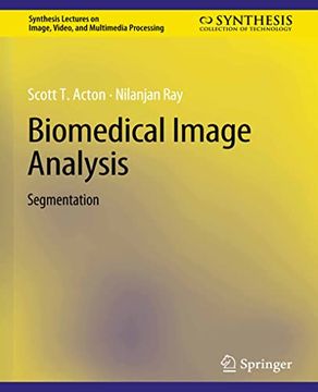 portada Biomedical Image Analysis: Segmentation