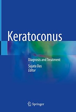 portada Keratoconus: Diagnosis and Treatment (en Inglés)