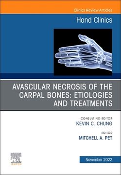 portada Avascular Necrosis of the Carpal Bones: Etiologies and Treatments, an Issue of Hand Clinics: Volume 38-4 (en Inglés)