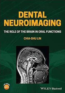 portada Dental Neuroimaging: The Role of the Brain in Oral Functions (en Inglés)