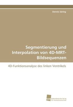 portada Segmentierung und Interpolation von 4D-MRT-Bildsequenzen: 4D-Funktionsanalyse des linken Ventrikels