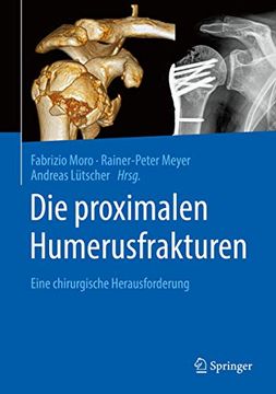 portada Die Proximalen Humerusfrakturen: Eine Chirurgische Herausforderung (en Alemán)