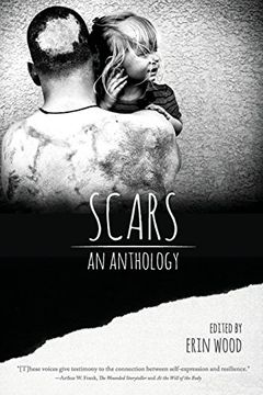 portada Scars: An Anthology (en Inglés)