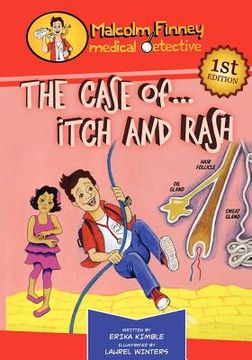 portada malcolm finney medical detective - the case of... itch and rash (in English)