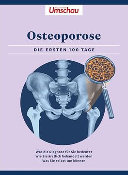 portada Apotheken Umschau: Osteoporose (en Alemán)