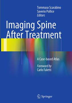 portada Imaging Spine After Treatment: A Case-Based Atlas (in English)