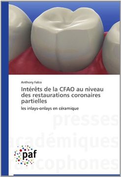 portada Intérêts de la CFAO au niveau des restaurations coronaires partielles: les inlays-onlays en céramique