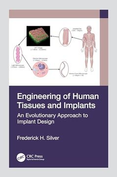 portada Engineering of Human Tissues and Implants: An Evolutionary Approach to Implant Design