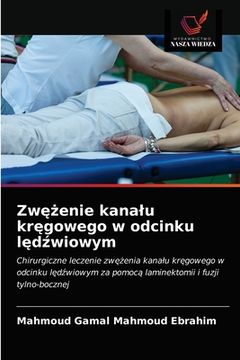 portada Zwężenie kanalu kręgowego w odcinku lędźwiowym (en Polaco)