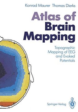 portada Atlas of Brain Mapping: Topographic Mapping of eeg and Evoked Potentials (en Inglés)
