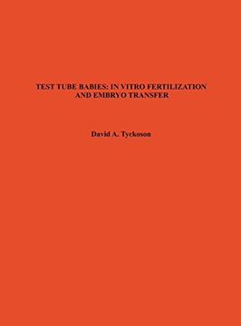 portada TEST TUBE BABIES: IN VITRO FERTILIZATION AND EMBRYO TRANSFER (Science Bibliographies S)