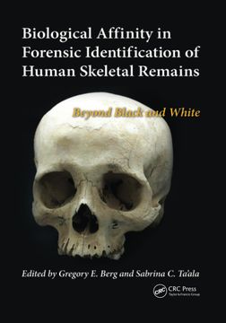 portada Biological Affinity in Forensic Identification of Human Skeletal Remains: Beyond Black and White (en Inglés)