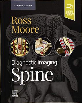 portada Diagnostic Imaging: Spine (en Inglés)