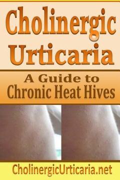 portada Cholinergic Urticaria: A Guide to Chronic Heat Hives (en Inglés)