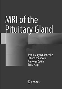 portada MRI of the Pituitary Gland (en Inglés)