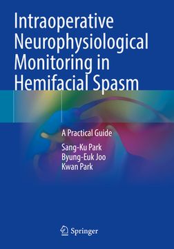 Intraoperative Neurophysiological Monitoring in Hemifacial Spasm: A Practical Guide (en Inglés)