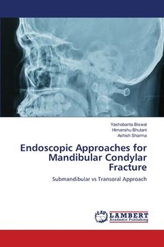 portada Endoscopic Approaches for Mandibular Condylar Fracture (en Inglés)