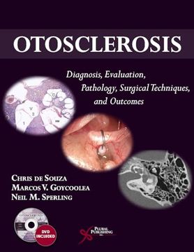 portada Otosclerosis: Diagnosis, Evaluation, Pathology, Surgical Techniques, and Outcomes (en Inglés)