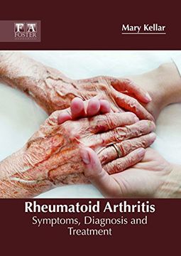 portada Rheumatoid Arthritis: Symptoms, Diagnosis and Treatment (in English)