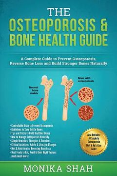 portada Osteoporosis: The Osteoporosis & Bone Health Guide: A Complete Guide to Prevent Osteoporosis, Reverse Bone Loss and Build Stronger B (en Inglés)