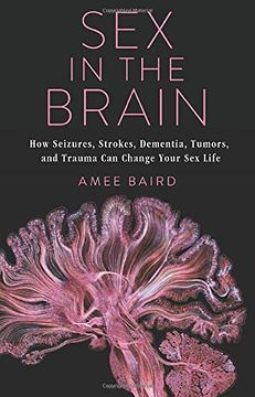 portada Sex in the Brain: How Seizures, Strokes, Dementia, Tumors, and Trauma can Change Your sex Life (en Inglés)